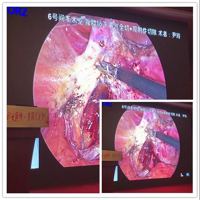 微信图片_20180904160020.jpg 微信图片_20180904160020.jpg